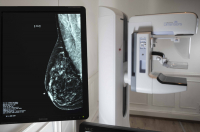 Salud: se realizarán mamografías y PAP gratuitos para prevenir enfermedades