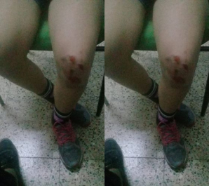 Denuncian una brutal golpiza a dos menores rodriguenses en Luján